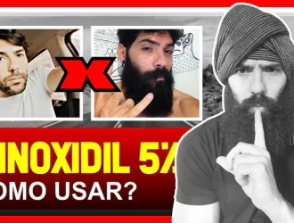 minoxidil como usar corretamente 720x