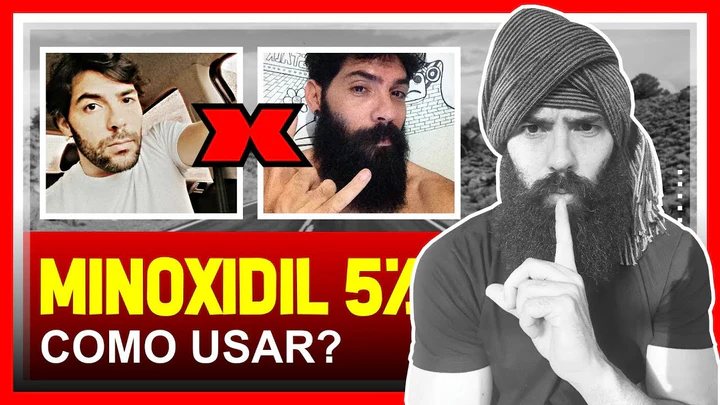 minoxidil como usar